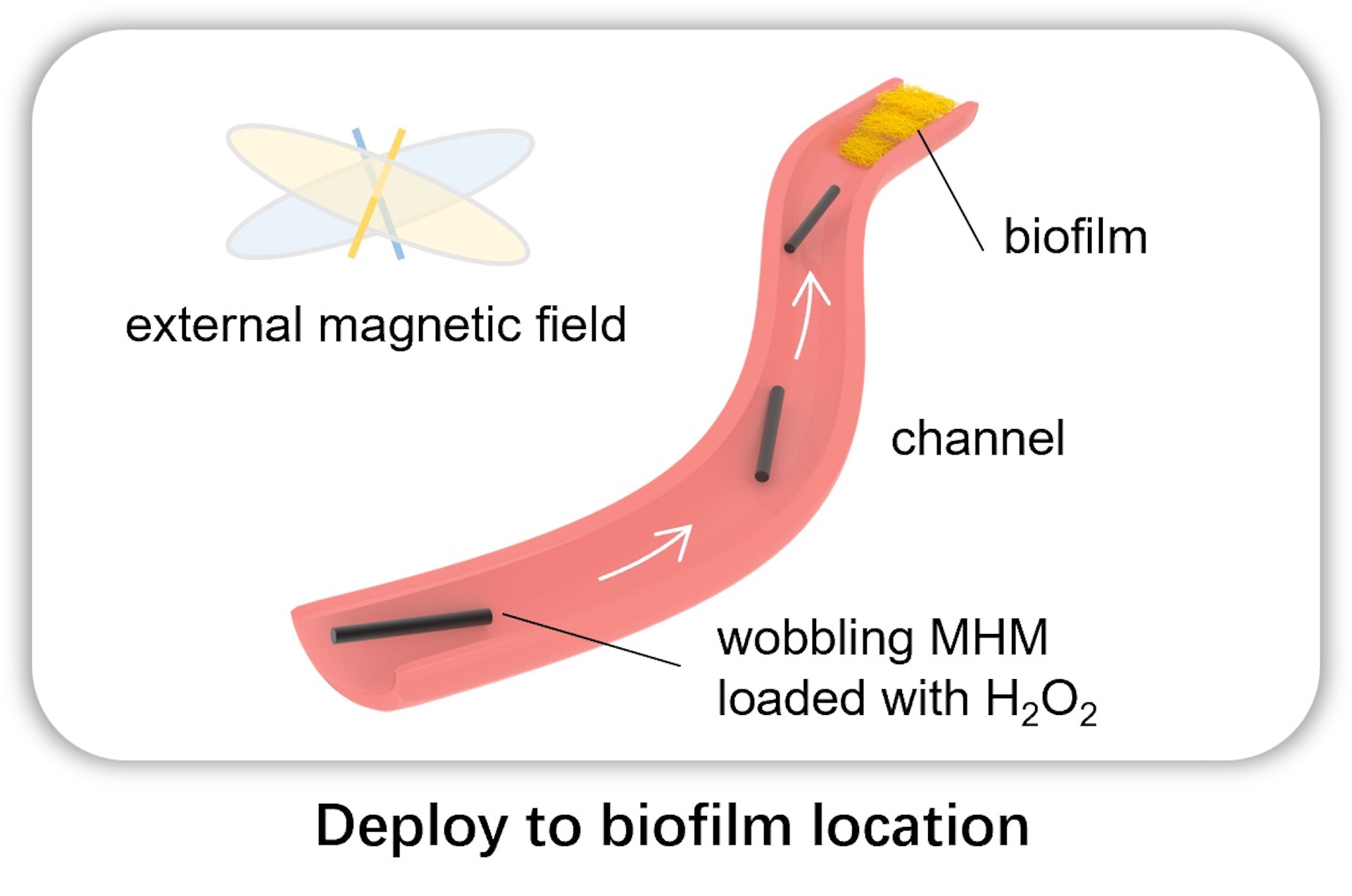 在外部磁場的驅動下，微型機械人前往菌膜所處位置。（香港中文大學提供）